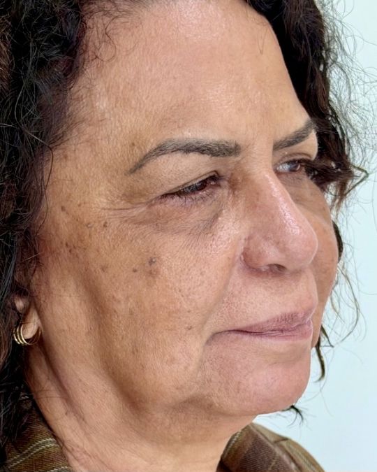 Rosto de paciente antes do procedimento